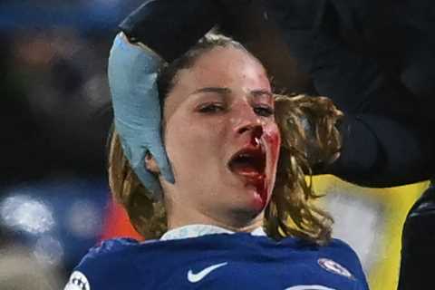 Chelsea star Melanie Leupolz forced off with nasty injury as blood streams down her face and fans fume at ref