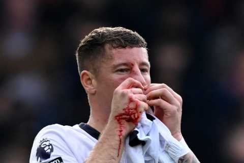 Ross Barkley left bloodied with broken nose during Luton vs Crystal Palace clash